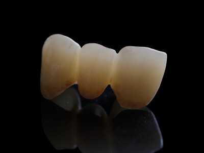 XTcera - 3D TypenMultilayer (1200 - 750mpa)