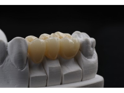 XTcera - 3D White